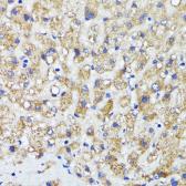 Anti-AMOTL2 antibody used in IHC (Paraffin sections) (IHC-P). GTX00661