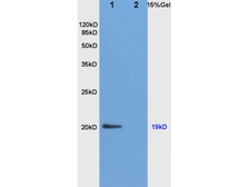 Anti-Nociceptin antibody used in Western Blot (WB). GTX00663