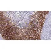 Anti-Claudin 4 antibody used in IHC (Paraffin sections) (IHC-P). GTX00667