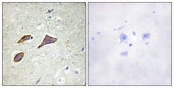 Anti-ENaC Beta (phospho Thr615) antibody used in IHC (Paraffin sections) (IHC-P). GTX00671