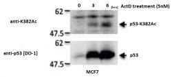 Anti-p53 (Acetyl Lys382) antibody [2B7E4] used in Western Blot (WB). GTX00676