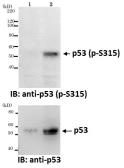 Anti-p53 (phospho Ser315) antibody [#18] used in Western Blot (WB). GTX00678