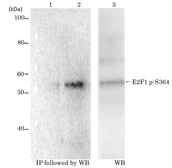 Anti-E2F1 (phospho Ser364) antibody [#2] used in Western Blot (WB). GTX00679