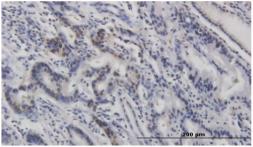 Anti-p53 (phospho Ser46) antibody [#36] used in IHC (Paraffin sections) (IHC-P). GTX00680