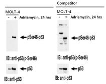 Anti-p53 (phospho Ser46) antibody [#36] used in Western Blot (WB). GTX00680