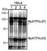 Anti-ATF6 antibody [37-1] used in Western Blot (WB). GTX00686