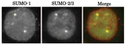Anti-SUMO1 antibody [4D12] used in Immunocytochemistry/ Immunofluorescence (ICC/IF). GTX00701