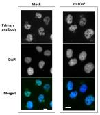 Anti-XPA antibody [5F12] used in Immunocytochemistry/ Immunofluorescence (ICC/IF). GTX00704