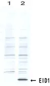 Anti-EID1 antibody [26] used in Western Blot (WB). GTX00710