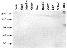 Anti-Haploid sperm cell-specific antigen antibody [TRA54] used in Western Blot (WB). GTX00716