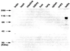 Anti-Germ cell-specific antigen antibody [TRA98] used in Western Blot (WB). GTX00717