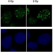 Anti-Rad51 antibody used in Immunocytochemistry/ Immunofluorescence (ICC/IF). GTX00719