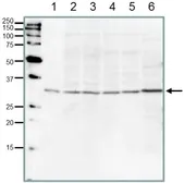Anti-PCNA antibody used in Western Blot (WB). GTX00723