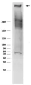 Anti-RANBP2 antibody used in Western Blot (WB). GTX00729