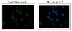 Anti-SCYL2 antibody used in Immunocytochemistry/ Immunofluorescence (ICC/IF). GTX00732
