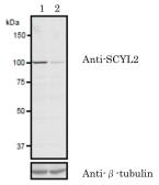 Anti-SCYL2 antibody used in Western Blot (WB). GTX00732