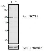 Anti-SCYL2 antibody used in Western Blot (WB). GTX00732