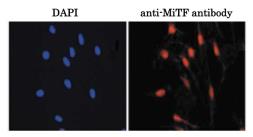 Anti-MITF antibody used in Immunocytochemistry/ Immunofluorescence (ICC/IF). GTX00738