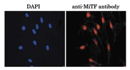 Anti-MITF antibody used in Immunocytochemistry/ Immunofluorescence (ICC/IF). GTX00738