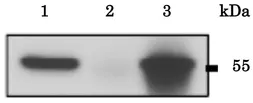 Anti-Calreticulin antibody used in Immunoprecipitation (IP). GTX00740