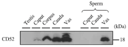 Anti-CD52 antibody used in Western Blot (WB). GTX00743