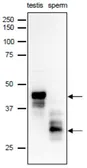Anti-SPACA1 antibody used in Western Blot (WB). GTX00749