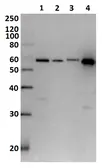 Anti-Diphtheria Toxin antibody used in Western Blot (WB). GTX00757