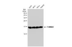 Anti-TOMM20 antibody [GT1136] used in Western Blot (WB). GTX00773