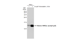 Anti-Histone H4K5ac (acetyl Lys5) antibody [GT1138] used in Western Blot (WB). GTX00775