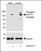 Anti-MYPT1 (phospho Ser668) antibody used in Western Blot (WB). GTX00776