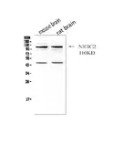 Anti-Mineralocorticoid Receptor antibody used in Western Blot (WB). GTX00779