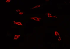 Anti-TLR4 antibody used in Immunocytochemistry/ Immunofluorescence (ICC/IF). GTX00783