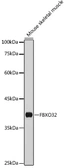 Anti-FBXO32 antibody used in Western Blot (WB). GTX00787