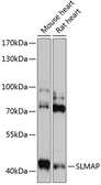 Anti-SLMAP antibody used in Western Blot (WB). GTX00790