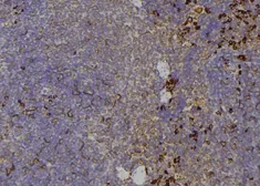 Anti-TIE2 (phospho Tyr992) antibody used in IHC (Paraffin sections) (IHC-P). GTX00794