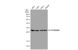 Anti-Prohibitin antibody [GT1139] used in Western Blot (WB). GTX00797