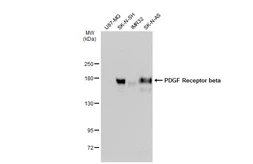 Anti-PDGF Receptor beta antibody [GT1140] used in Western Blot (WB). GTX00798