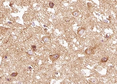 Anti-TrkB (phospho Tyr515) antibody used in IHC (Paraffin sections) (IHC-P). GTX00804