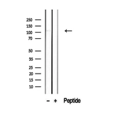 Anti-PACS2 antibody used in Western Blot (WB). GTX00808