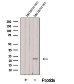 Anti-DDIT4L antibody used in Western Blot (WB). GTX00809