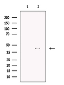 Anti-FBXO32 antibody used in Western Blot (WB). GTX00810
