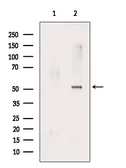 Anti-RUNX2 (phospho Ser28) antibody used in Western Blot (WB). GTX00811
