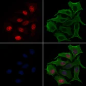 Anti-RUNX2 (phospho Ser275) antibody used in Immunocytochemistry/ Immunofluorescence (ICC/IF). GTX00813