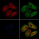 Anti-OSBPL2 antibody used in Immunocytochemistry/ Immunofluorescence (ICC/IF). GTX00814