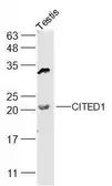 Anti-CITED1 antibody used in Western Blot (WB). GTX00820