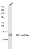 Anti-RELM alpha antibody used in Western Blot (WB). GTX00822