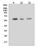 Anti-RUNX2 antibody used in Western Blot (WB). GTX00829