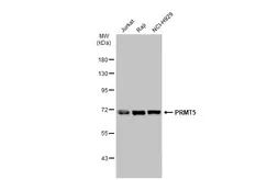 Anti-PRMT5 antibody [GT1142] used in Western Blot (WB). GTX00832