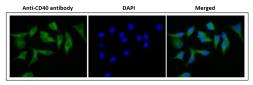 Anti-CD40 antibody [5C3] (FITC) used in Immunocytochemistry/ Immunofluorescence (ICC/IF). GTX00854