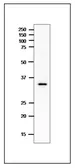 Anti-Clostridium perfringens enterotoxin (CPE) antibody used in Western Blot (WB). GTX00879